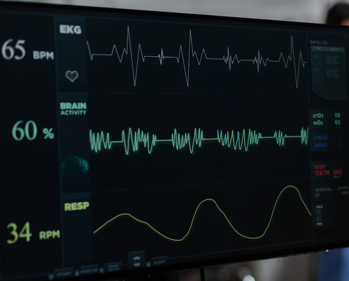 Heart Rate Variability (HRV) Trends